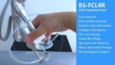 laser frazionario di CO2 per le cicatrici dell'acne