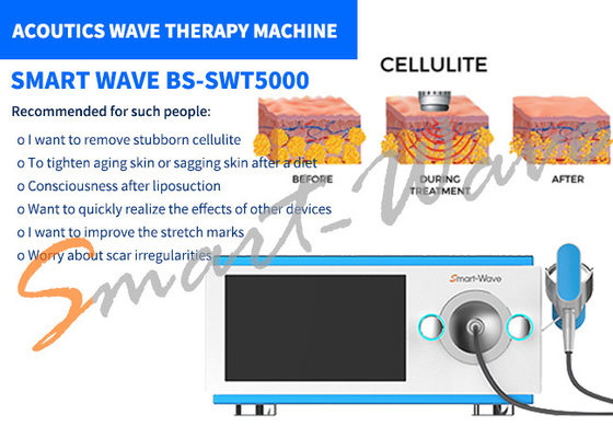 Macchina di terapia di Wave acustico di 6 trasmettitori per rimozione delle smagliature/rimodellamento del corpo