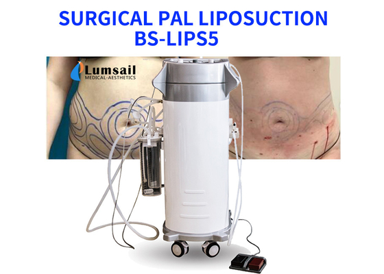 Il potere di BS-LIPS5 300W ha assistito l'attrezzatura della liposuzione per il seno e Chin del collo