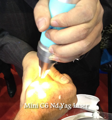 ND 1064 della macchina di rimozione del tatuaggio del laser di Yag dell'alta energia Yag 532 nanometro con CE approvato