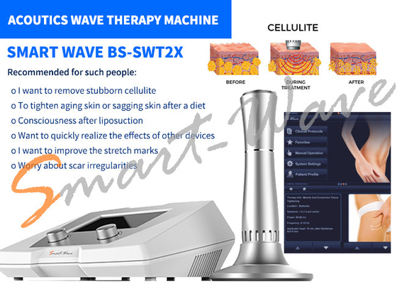 Rimozione delle celluliti della macchina di terapia del salone di bellezza BS-SWT2X Wave acustico una garanzia da 1 anno