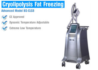 Dimagramento/che modella del corpo la macchina di congelamento grassa di Cryolipolysis con controllo della temperatura intelligente