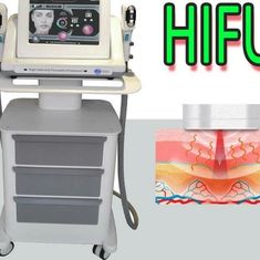 Ultrasuono multiplo HIFU della cartuccia che dimagrisce trattamento indolore a macchina