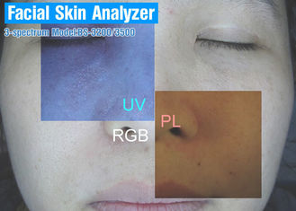 La macchina di prova portatile della pelle della macchina dell'analisi della pelle per il fronte ha migliorato/ringiovanimento