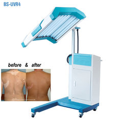 Macchina di terapia della luce di trattamento UVB di fototerapia, terapia leggera a banda stretta di UVB
