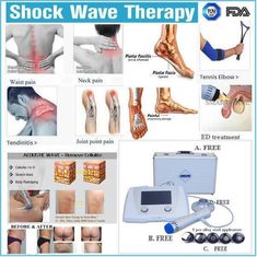 Alta macchina di terapia di trattamento ESWT Shockwave di risultato di effetto per il trattamento di fratture di sforzo